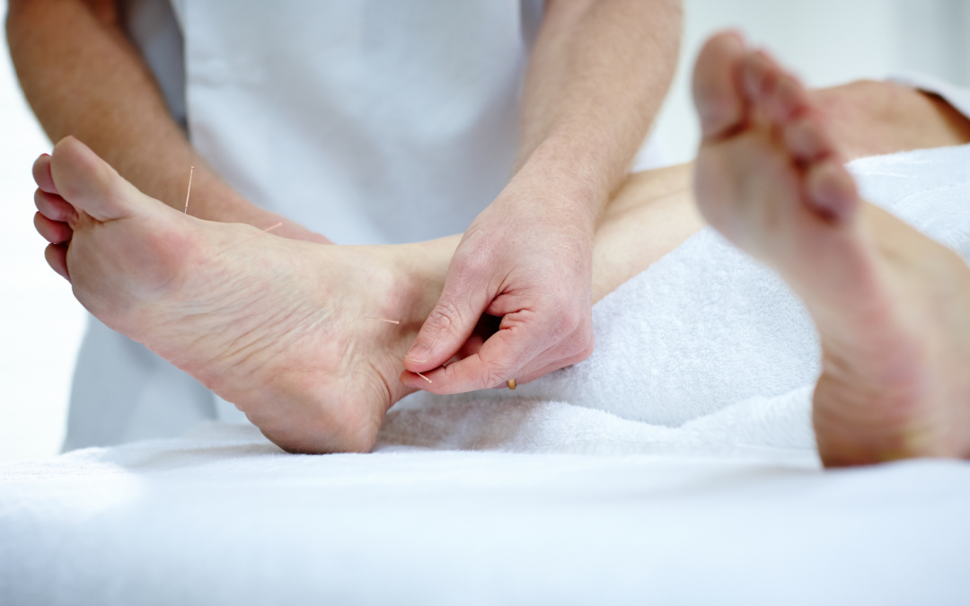 Acupuncture & Plantar Fasciitis