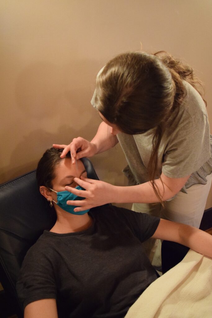 The acupuncturist gently places an acupuncture needle between the patient's eyebrows curing Community Acupuncture.